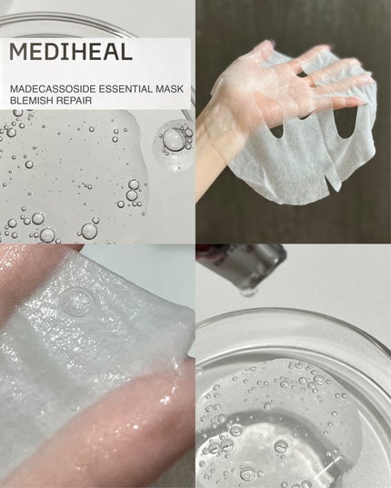 マデカッソシド エッセンシャルマスク/MEDIHEAL/シートマスク・パックを使ったクチコミ(4枚目)