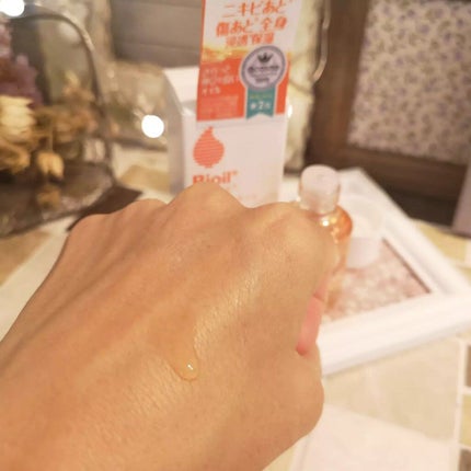 バイオイル/バイオイル/フェイスオイルを使ったクチコミ(2枚目)