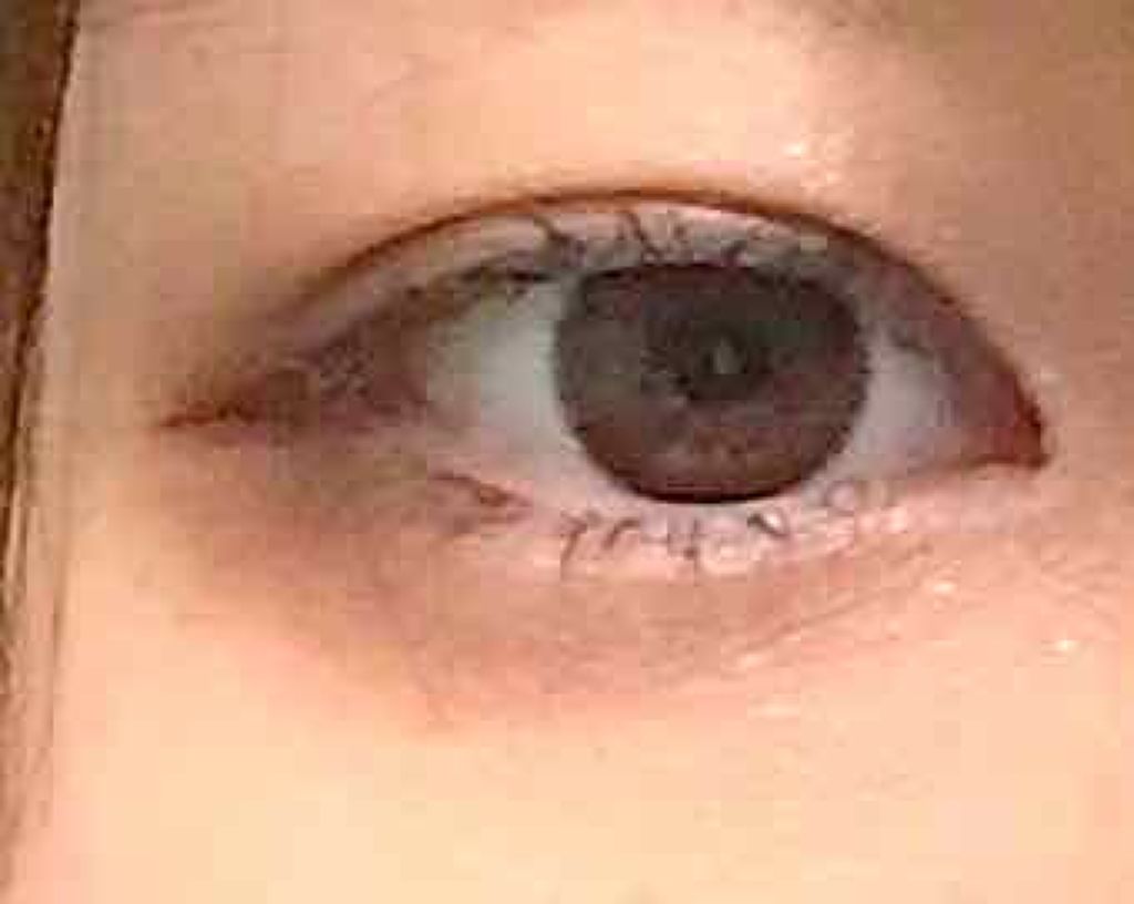 リキッドフィルム/ラクオリ/二重まぶた用アイテムを使ったクチコミ(2枚目)