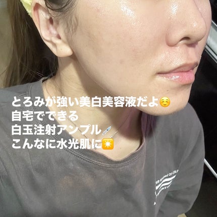 DW-EGFワンデイズアンプル/Easydew/美容液を使ったクチコミ(6枚目)