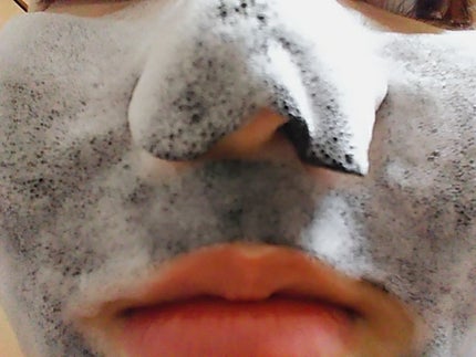 炭酸バブルシート/MEDIHEAL/シートマスク・パックを使ったクチコミ(1枚目)