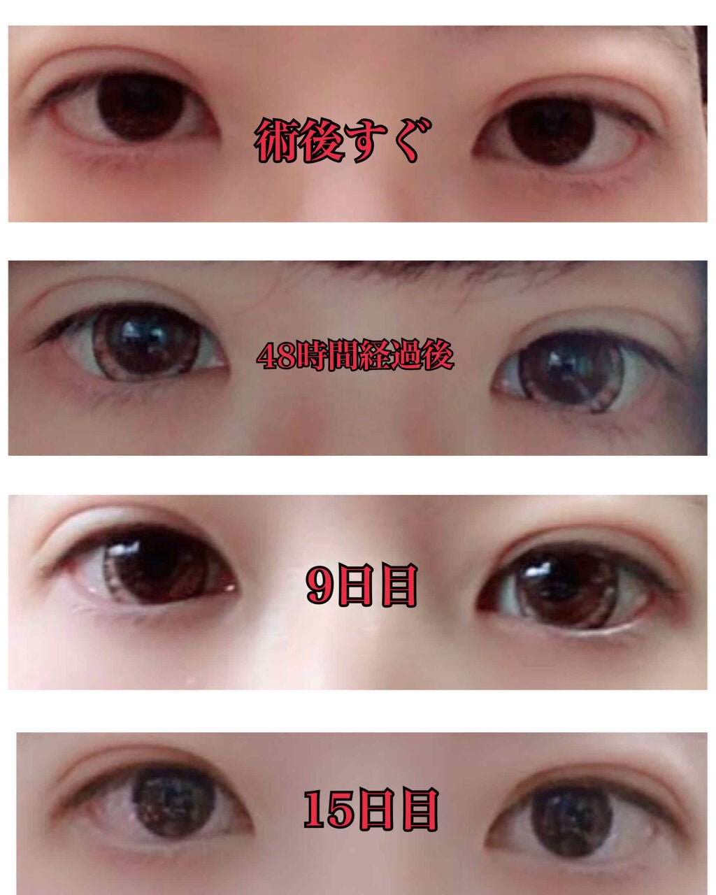 㪠ð° on LIPS ãðäºéæŽåœ¢ããã©ãŒã¢ãã¿ãŒð2018幎æ«ã«ãããæŽåœ¢ãããŸãã..ãïŒ2æç®ïŒ