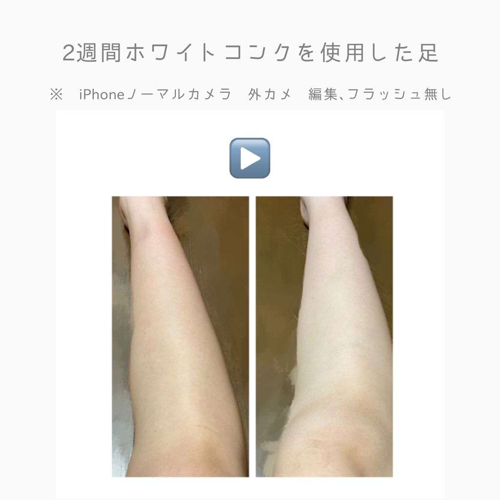 薬用ホワイトコンク ボディシャンプーC II/ホワイトコンク/ボディソープを使ったクチコミ（3枚目）