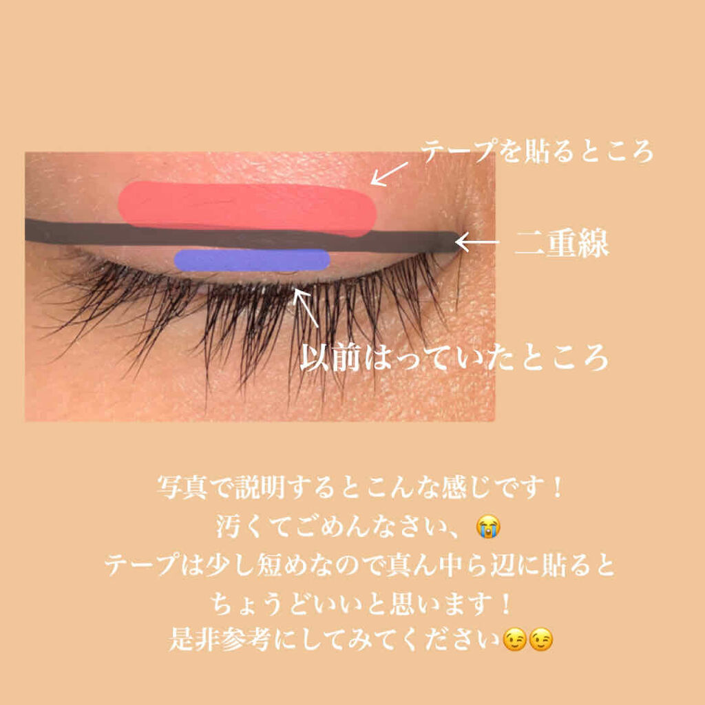 アイトーク スーパーウォータープルーフ/アイトーク/二重まぶた用アイテムを使ったクチコミ（3枚目）