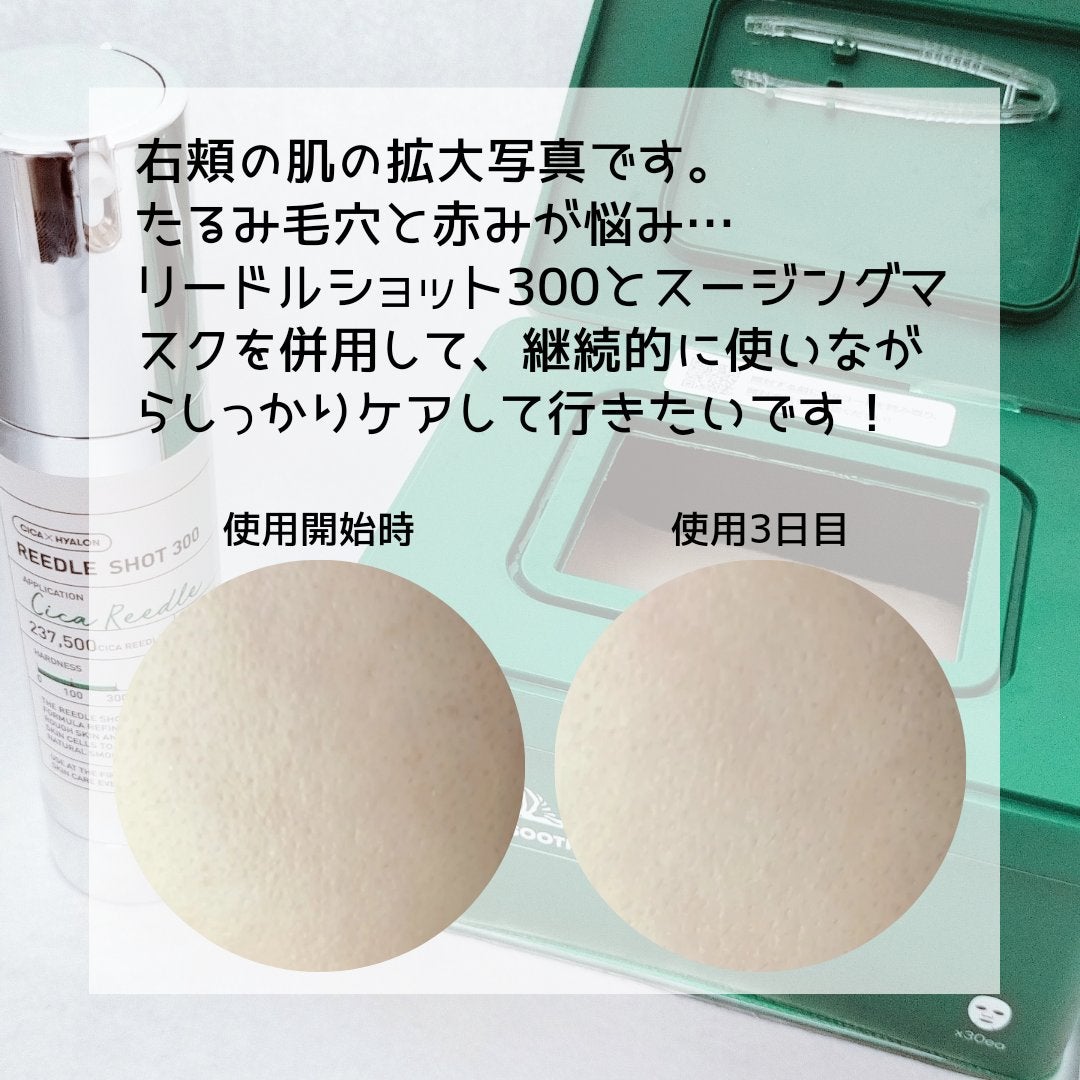 CICA デイリースージングマスク/VT/シートマスク・パックを使ったクチコミ(5枚目)