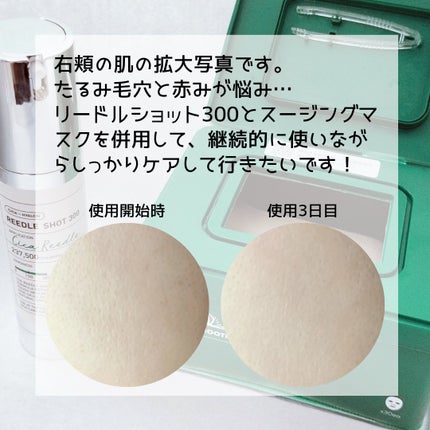 CICA デイリースージングマスク/VT/シートマスク・パックを使ったクチコミ(5枚目)