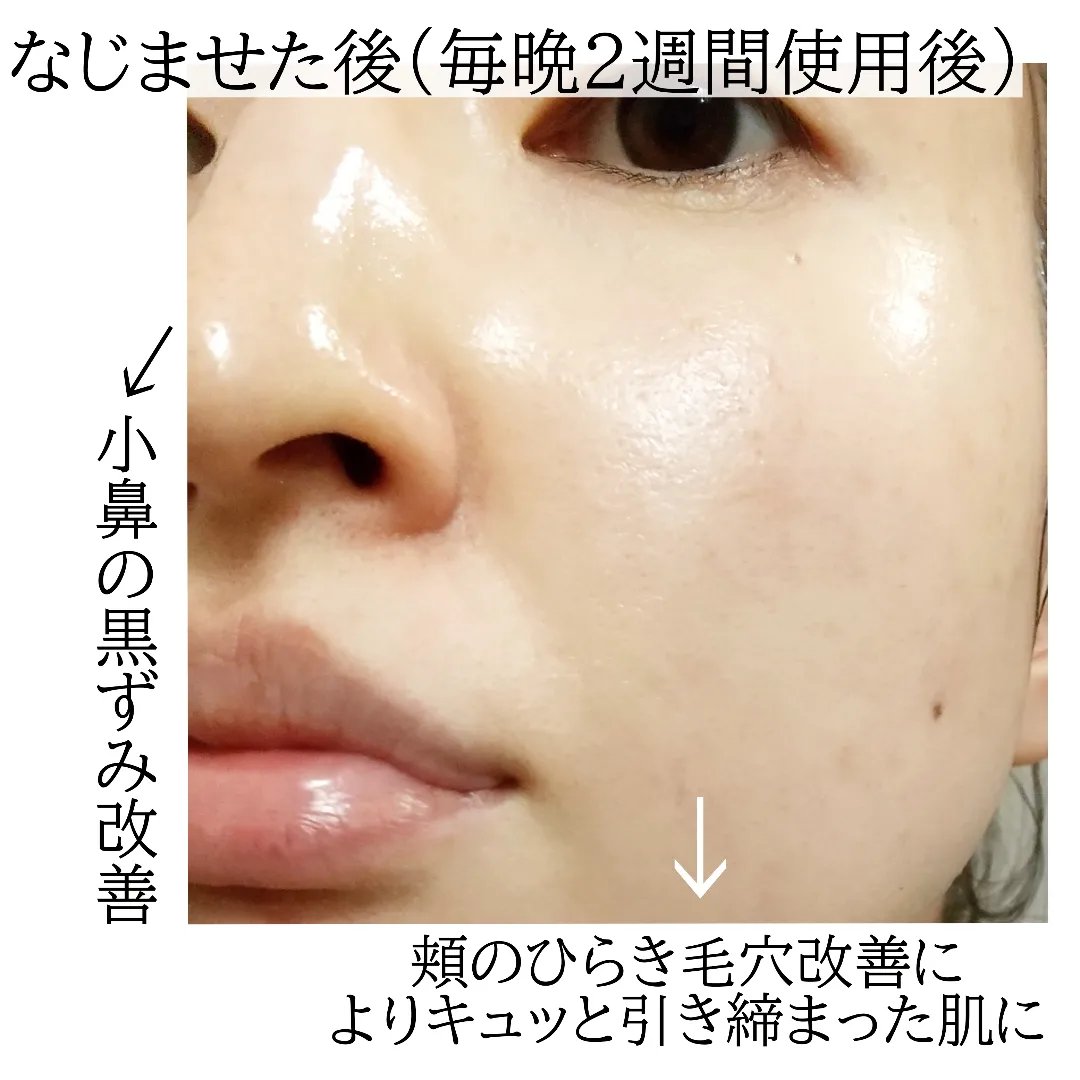 アゼフィットバランシングVCローション/NIKI PITA/化粧水を使ったクチコミ（3枚目）