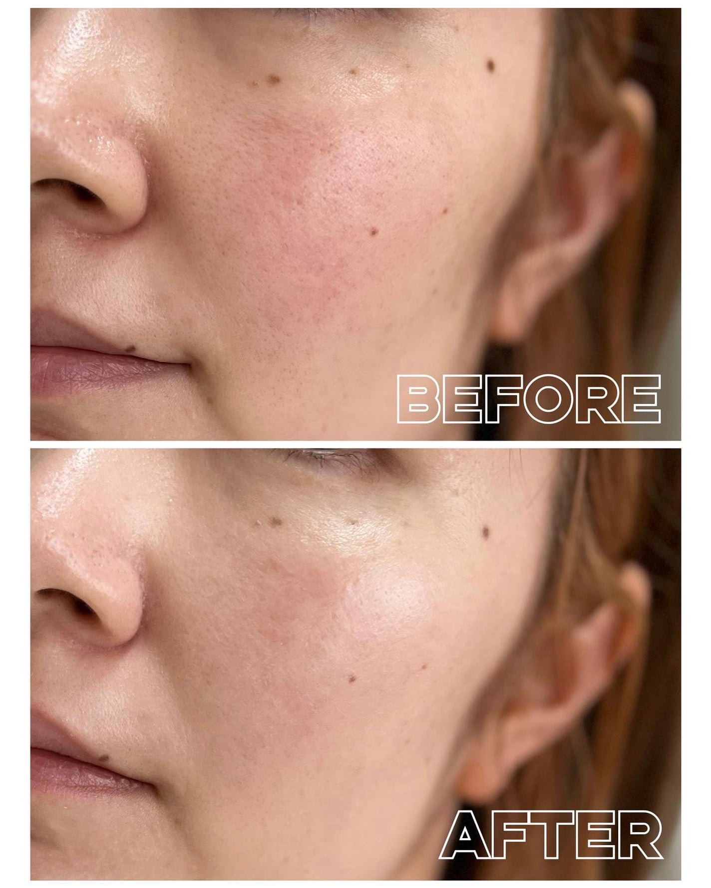 ルフレ バランシングおしろいミルク GR/エリクシール/乳液を使ったクチコミ(3枚目)