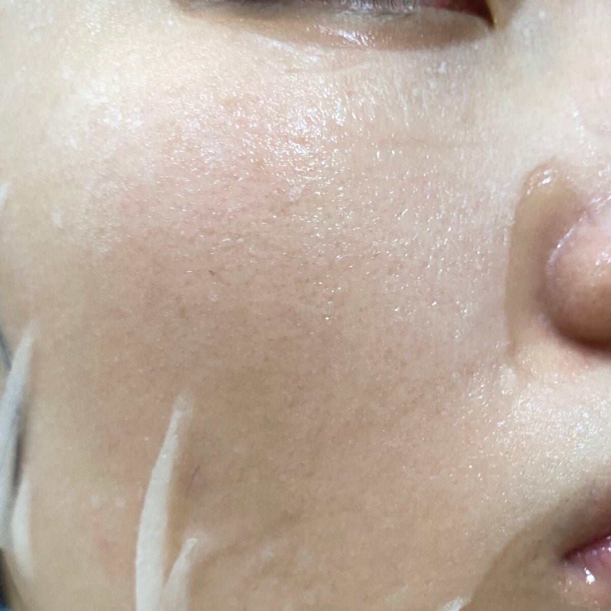 ドクタージャルト ダーマスク ウォータージェット バイタルハイドラソリューション/Dr.Jart+/シートマスク・パックを使ったクチコミ(6枚目)