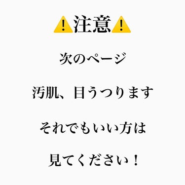 アイトーク スーパーウォータープルーフ/アイトーク/二重まぶた用アイテムを使ったクチコミ（3枚目）