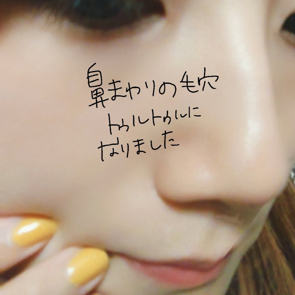 スーパー毛穴ピールセラム/ラボラボ/美容液を使ったクチコミ(3枚目)