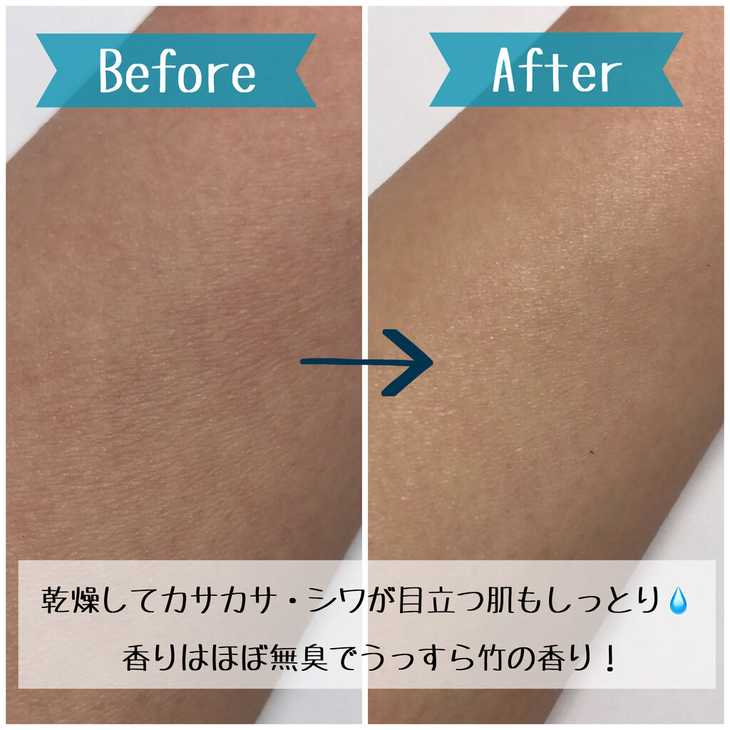 スードバンブートナー/KEEP COOL/化粧水を使ったクチコミ（3枚目）