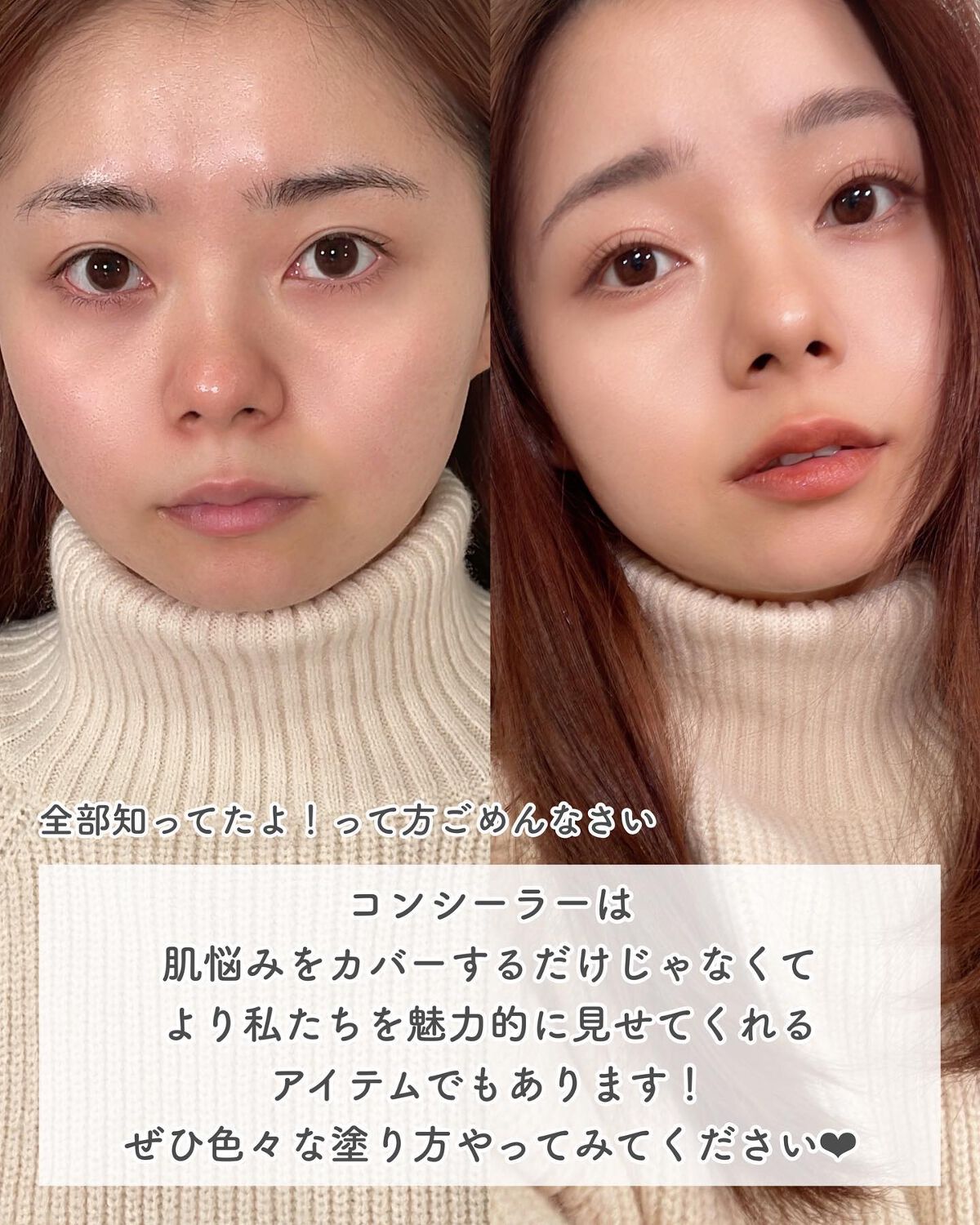 コスメコンシェルジュのチャンさん on LIPS 「もっと有効的なコンシーラーの使い方3選❤︎今回は、Goss師匠..」(5枚目)