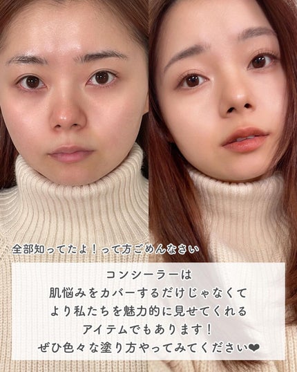 コスメコンシェルジュのチャンさん on LIPS 「もっと有効的なコンシーラーの使い方3選❤︎今回は、Goss師匠..」(5枚目)