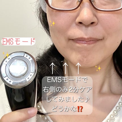 チロコナノ on LIPS 「⭐️ANLAN温冷美顔器⭐️ANLANの温冷美顔器は5千円台⁉..」(7枚目)