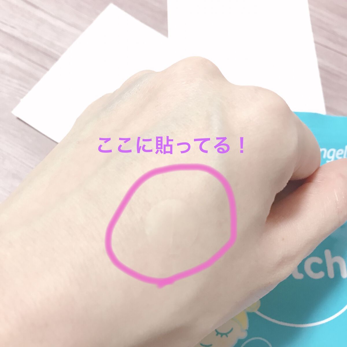 クリアパッチ/Angelab/にきびパッチを使ったクチコミ（3枚目）