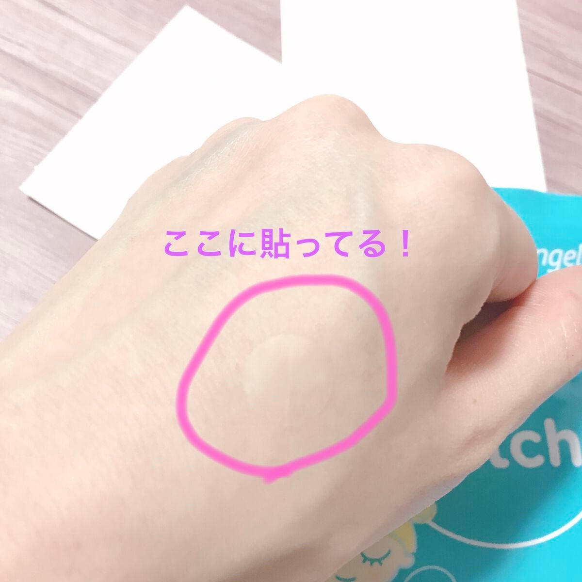 クリアパッチ/Angelab/にきびパッチを使ったクチコミ(3枚目)