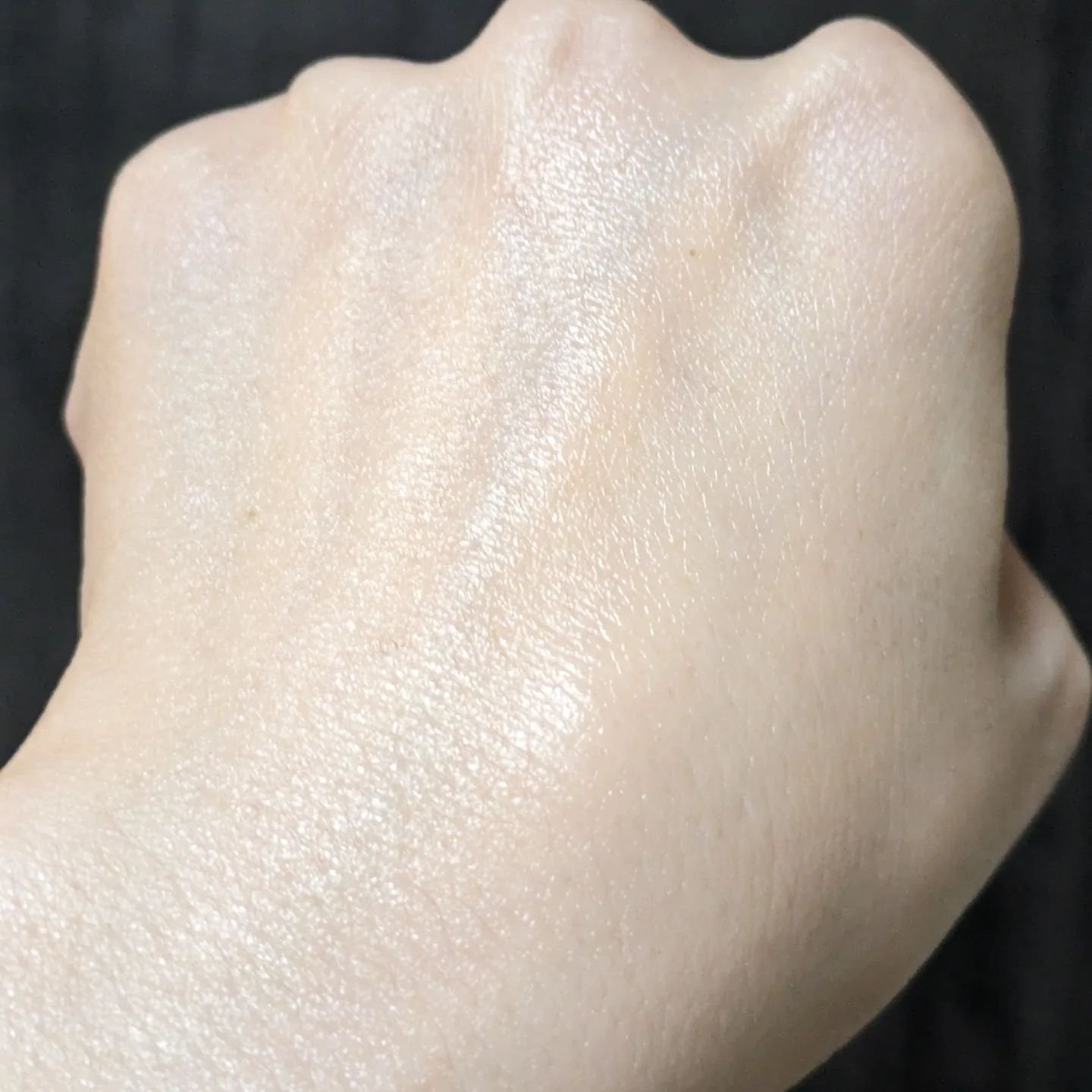 ピンクティーツリートナー/APLIN/化粧水を使ったクチコミ（3枚目）