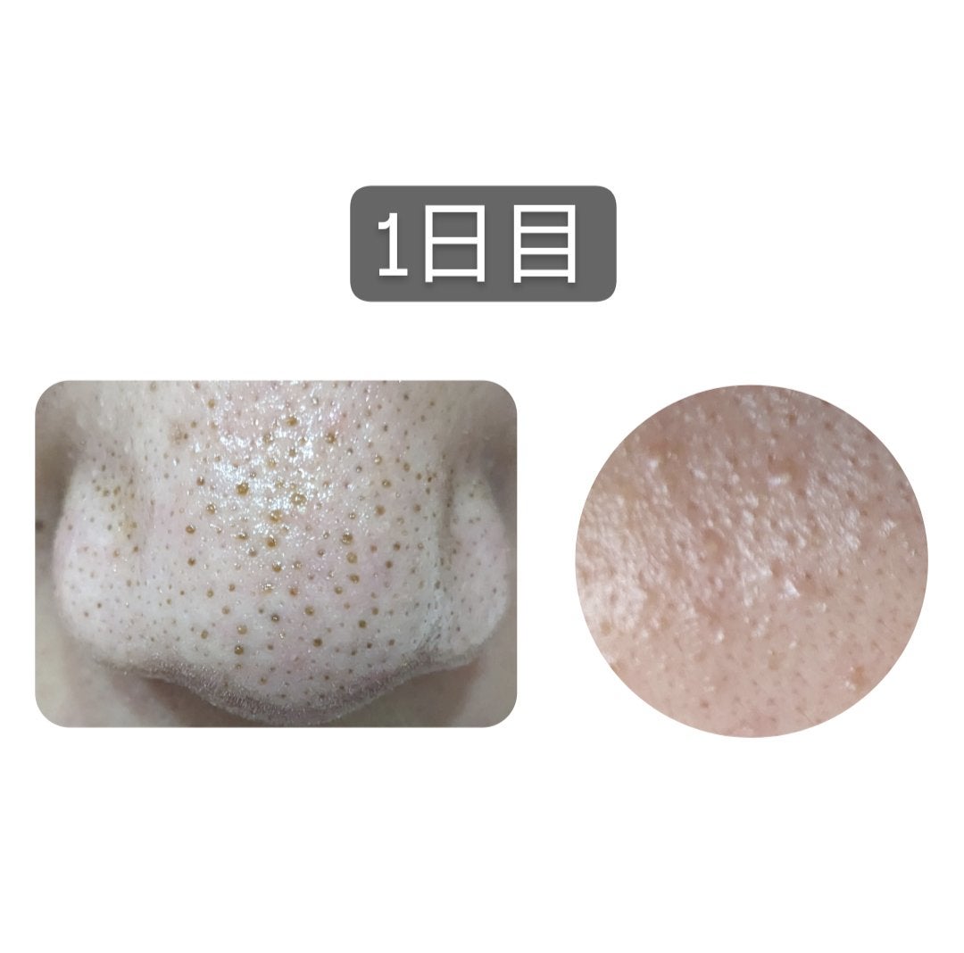 DHC ビタミンCハードカプセル/DHC/美容サプリメントを使ったクチコミ(2枚目)