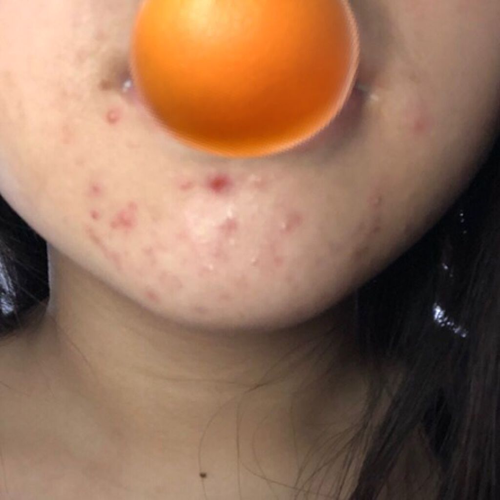 化粧水・敏感肌用・高保湿タイプ/無印良品/化粧水を使ったクチコミ(2枚目)