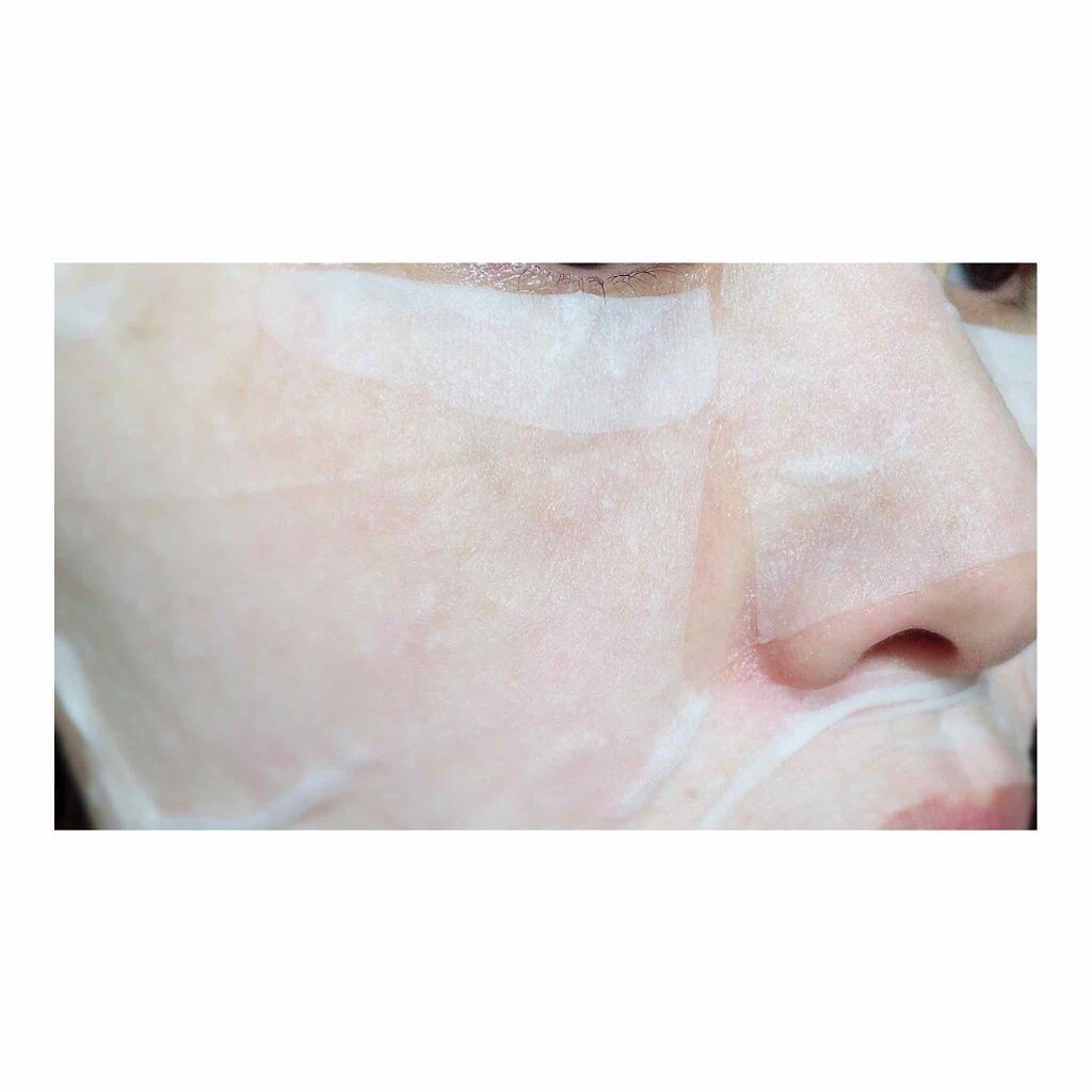 シートマスク モイスト/BOTANICAL ESTHE/シートマスク・パックを使ったクチコミ(3枚目)