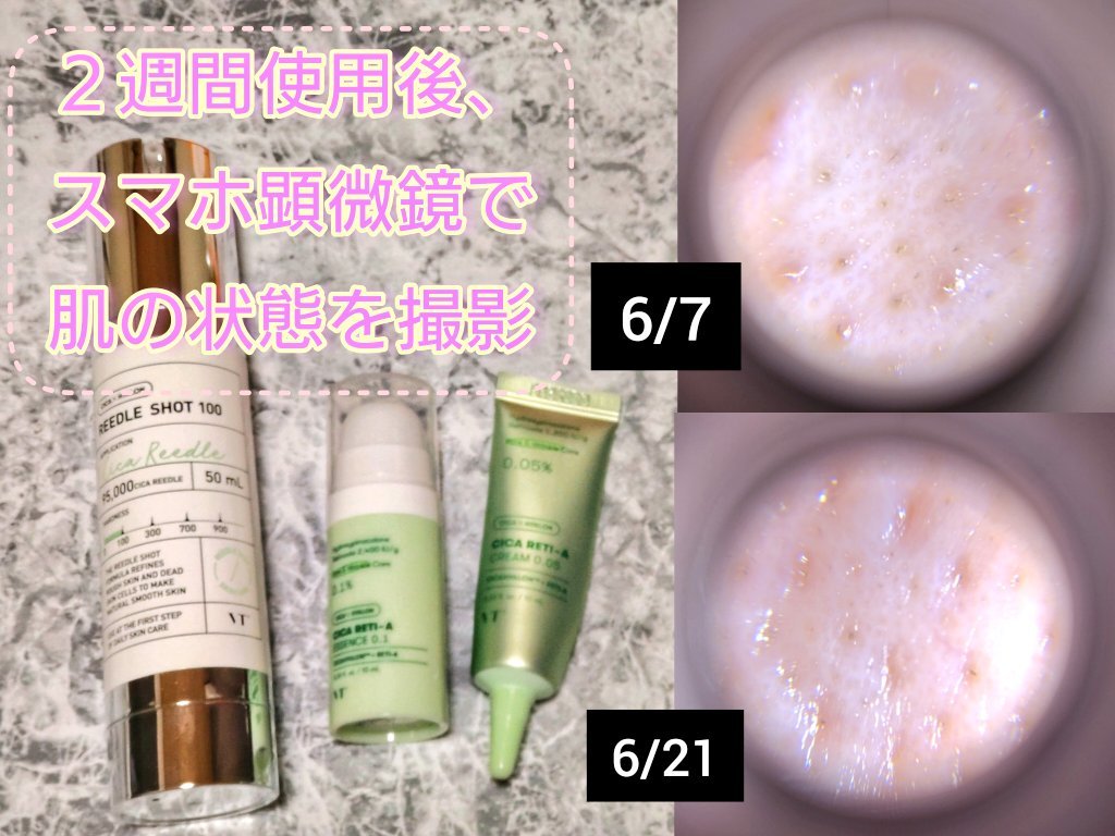 CICA デイリースージングマスク/VT/シートマスク・パックを使ったクチコミ（2枚目）