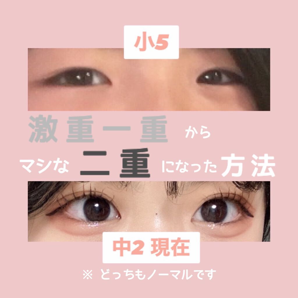 のびーるアイテープ（絆創膏タイプ、レギュラー）/DAISO/二重まぶた用アイテムを使ったクチコミ（1枚目）