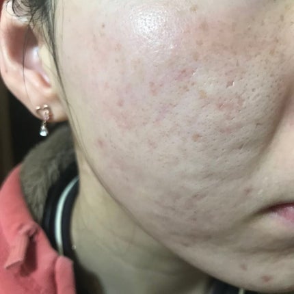 Cサスペンション23+HAスフィア2フェイスクリーム/The Ordinary/美容液を使ったクチコミ(1枚目)