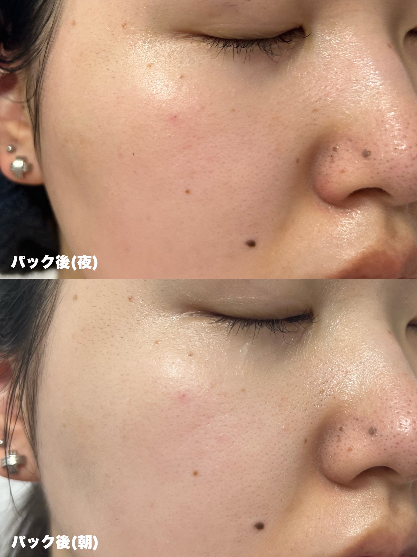 ザ・ダーマ ベストVC100プラスレチノール/クオリティファースト/シートマスク・パックを使ったクチコミ(4枚目)