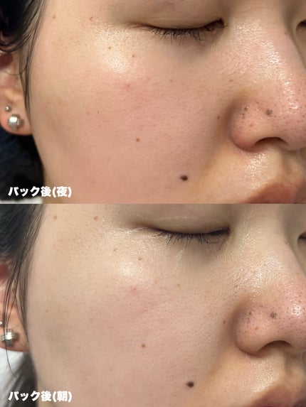 ザ・ダーマ ベストVC100プラスレチノール/クオリティファースト/シートマスク・パックを使ったクチコミ(4枚目)