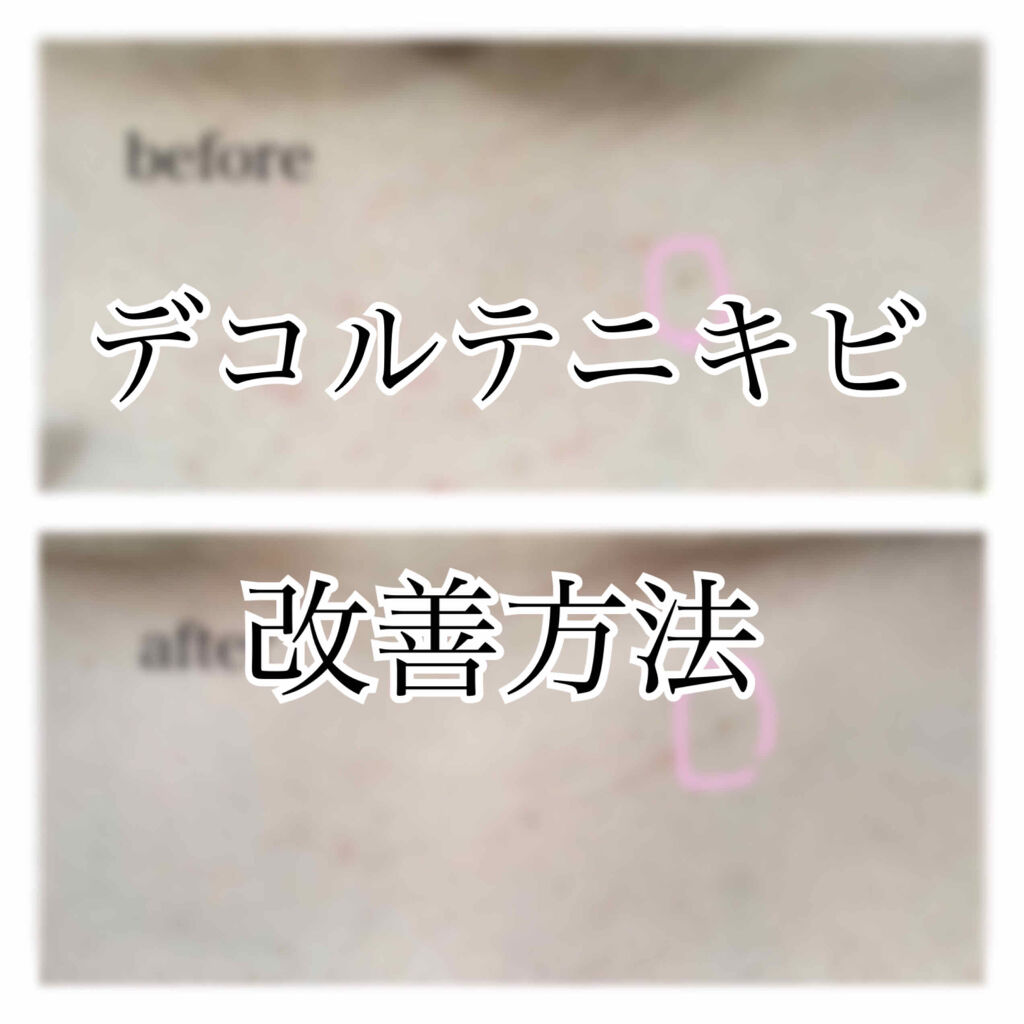 化粧水・敏感肌用・しっとりタイプ/無印良品/化粧水を使ったクチコミ（1枚目）