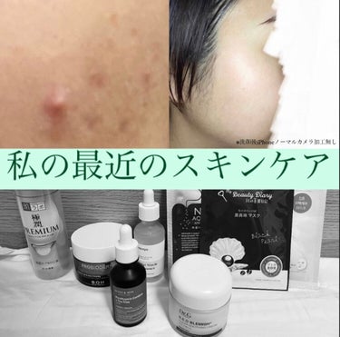 Houttuynia Cordata + Tea Tree Serum/MARY&MAY/洗顔フォームを使ったクチコミ（1枚目）