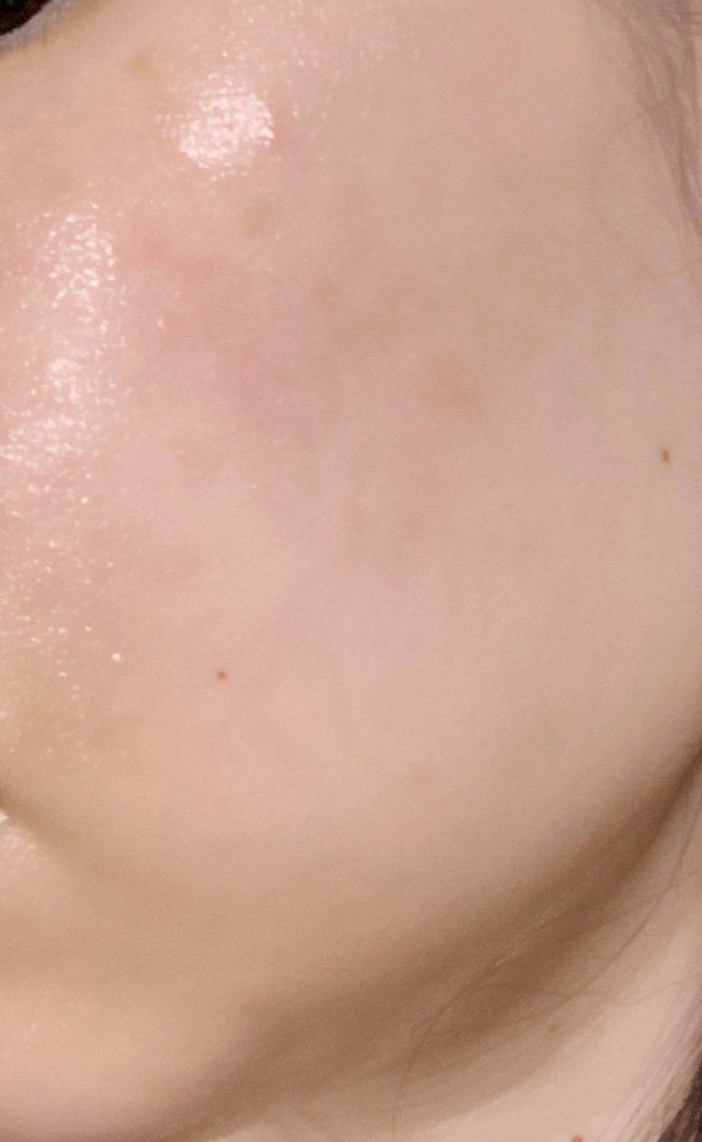 RMK Wトリートメントオイル/RMK/ブースター・導入液を使ったクチコミ（2枚目）