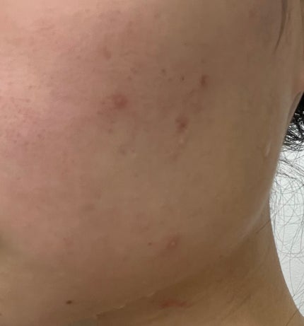 シカペプタリペアセラム/Neulii/美容液を使ったクチコミ(2枚目)