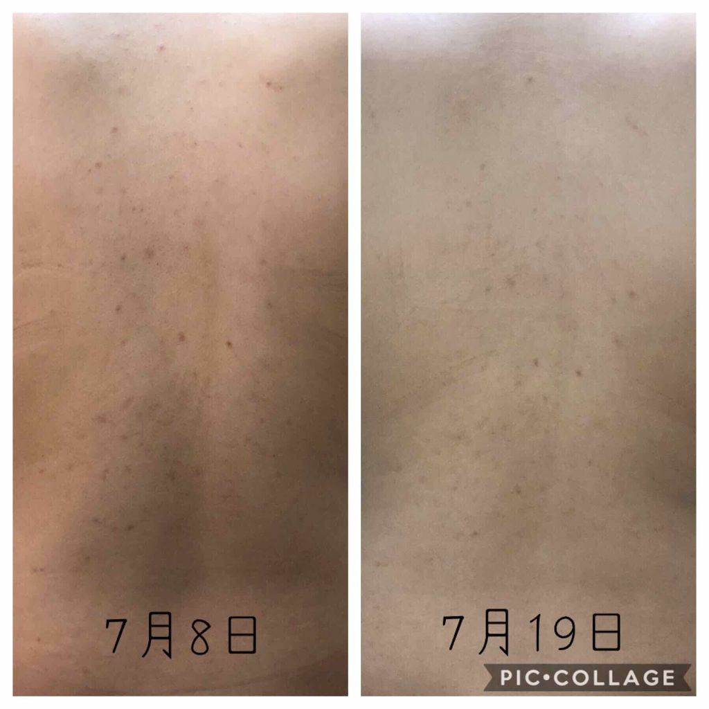 薬用スキンコンディショナー/オードメディカ/ボディローションを使ったクチコミ（3枚目）