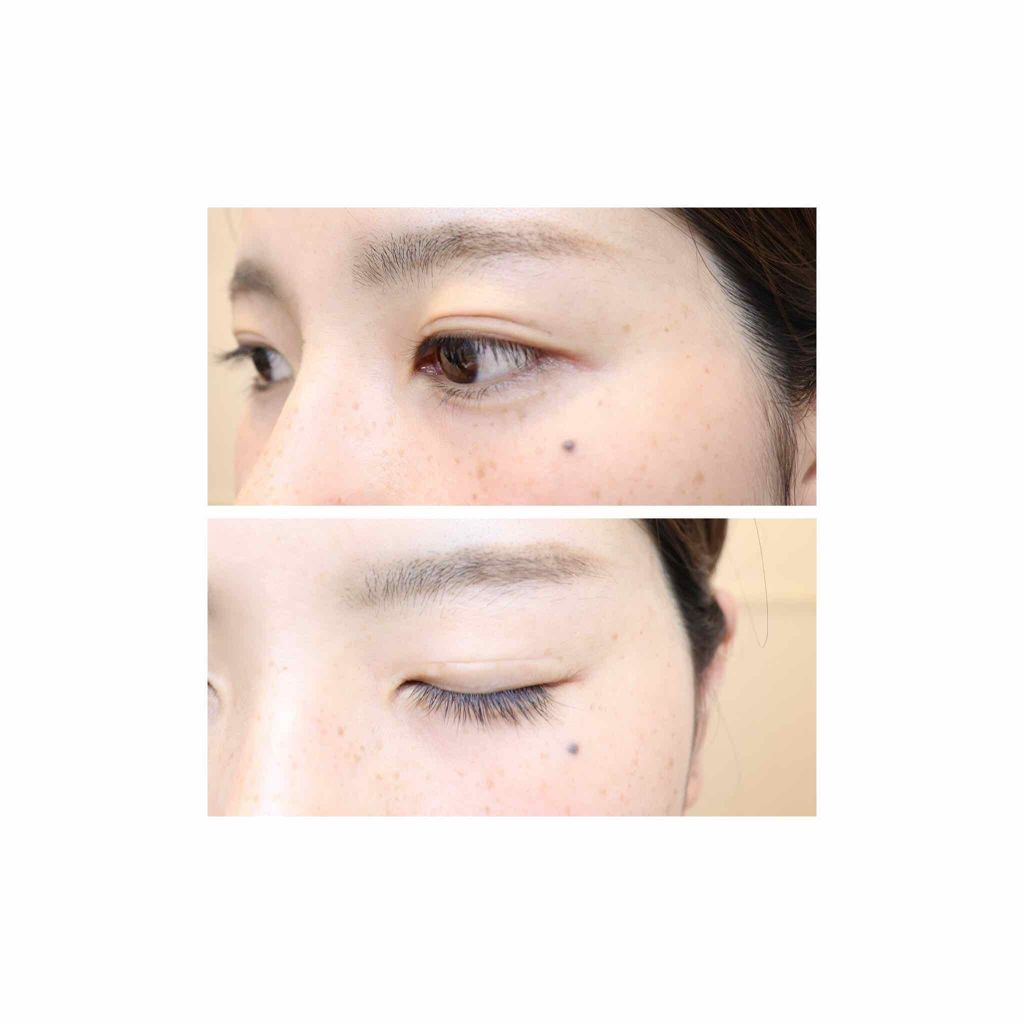 フリーファイバー120 スタンダードタイプ /メザイク/二重まぶた用アイテムを使ったクチコミ(4枚目)