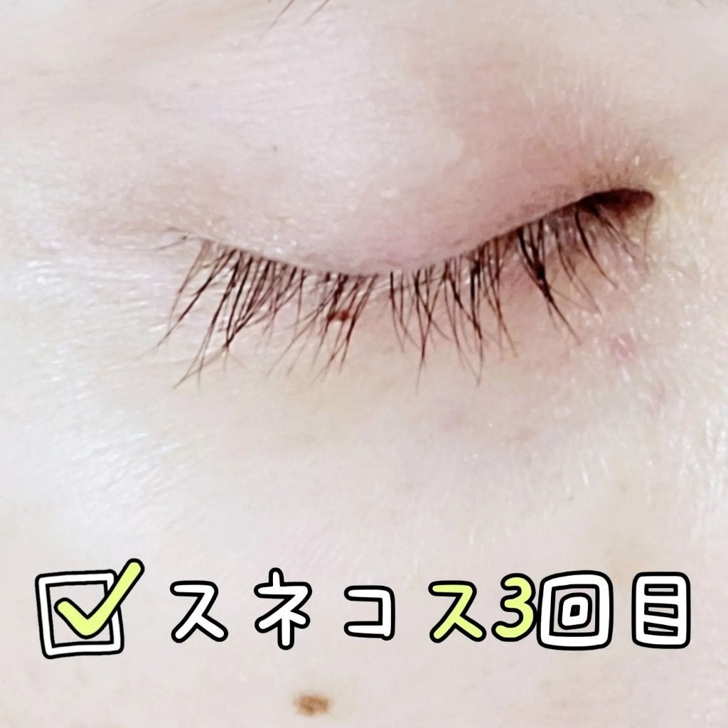 ちょこ on LIPS 「前回の施術から2週間スネコス3回目終了ですが、結果は大..」(1枚目)