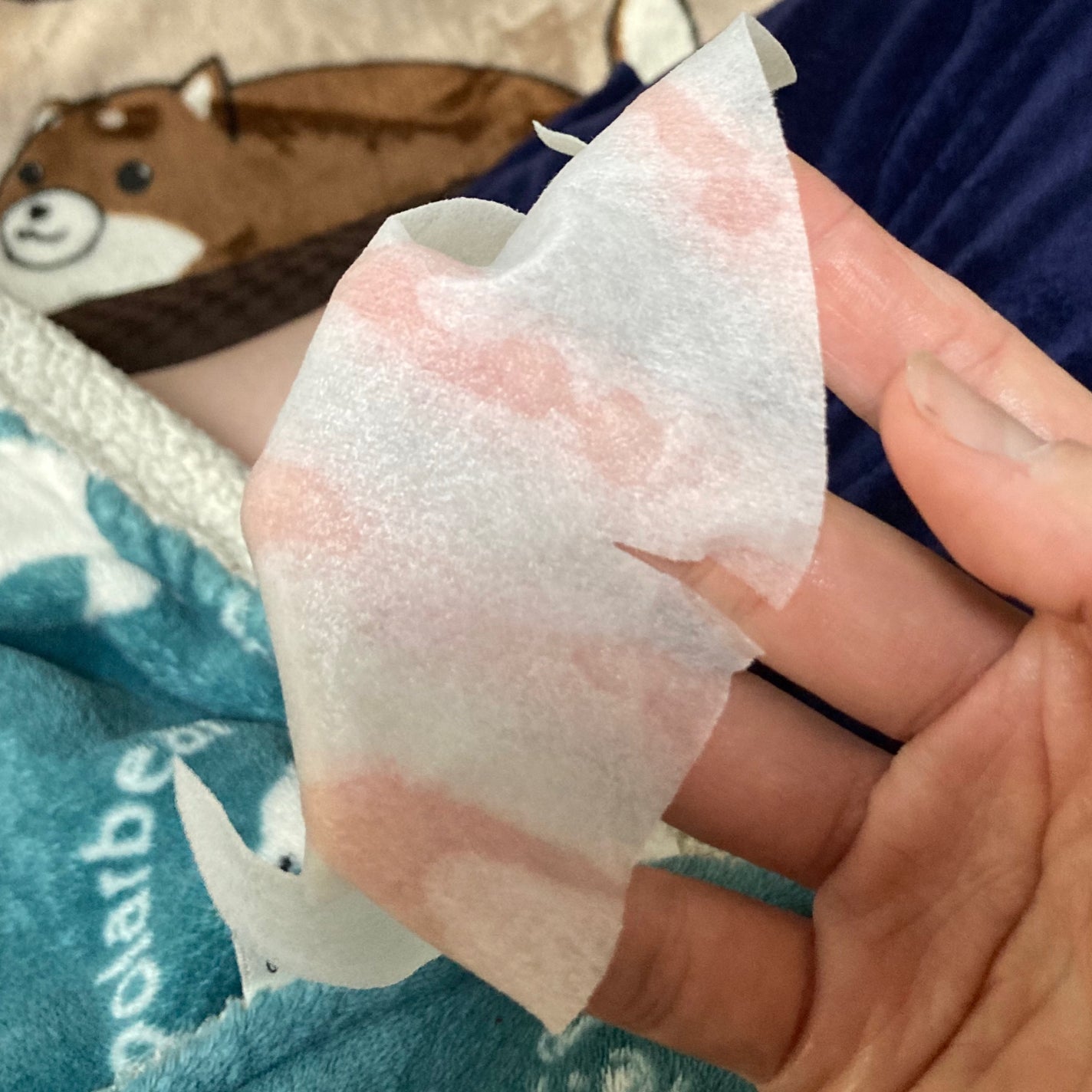 毛穴ケア フェイシャルマスク/MITOMO/シートマスク・パックを使ったクチコミ(2枚目)