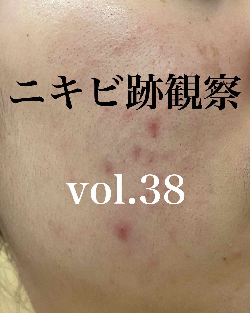 Cセラム/b.glen/美容液を使ったクチコミ（1枚目）