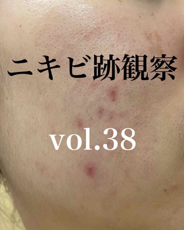 敏感肌用薬用美白美容液/無印良品/美容液を使ったクチコミ（1枚目）