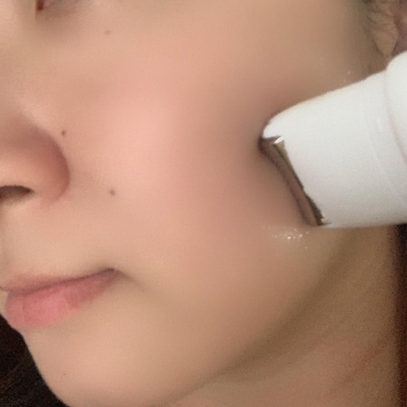 ナイアシンアミド20セラム/PESTLO/美容液を使ったクチコミ(4枚目)