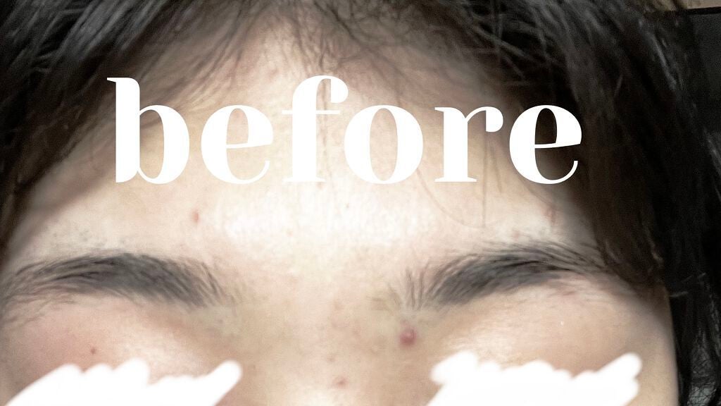 オリジナル ピュアスキンジェリー/ヴァセリン/ボディクリームを使ったクチコミ(5枚目)