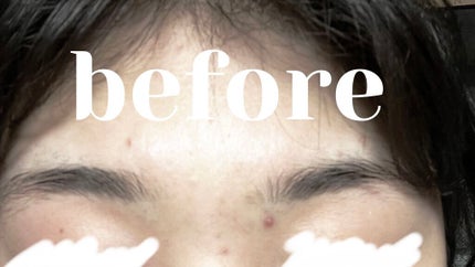 オリジナル ピュアスキンジェリー/ヴァセリン/ボディクリームを使ったクチコミ(5枚目)