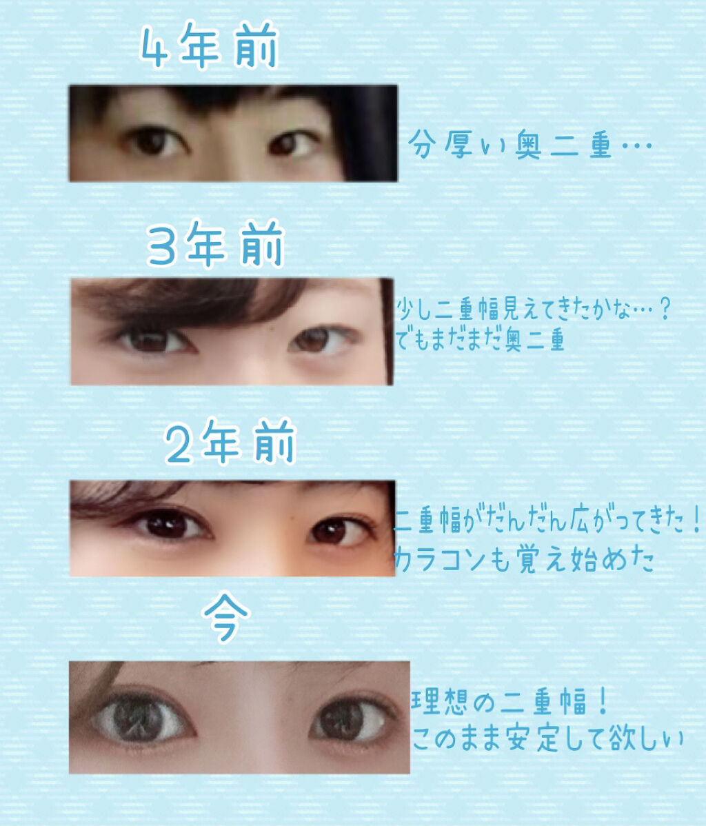 アイテープ片面(のびる)絆創膏タイプ スリム 120枚/セリア/二重まぶた用アイテムを使ったクチコミ（2枚目）