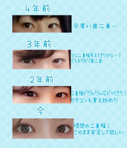 アイテープ片面(のびる)絆創膏タイプ スリム 120枚/セリア/二重まぶた用アイテムを使ったクチコミ(2枚目)