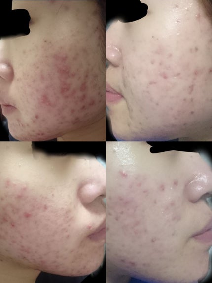 白色ワセリン(医薬品)/健栄製薬/その他を使ったクチコミ(2枚目)