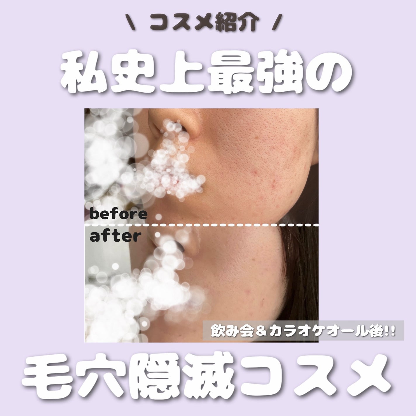 カラーミキシングコンシーラー/キャンメイク/パレットコンシーラーを使ったクチコミ(1枚目)