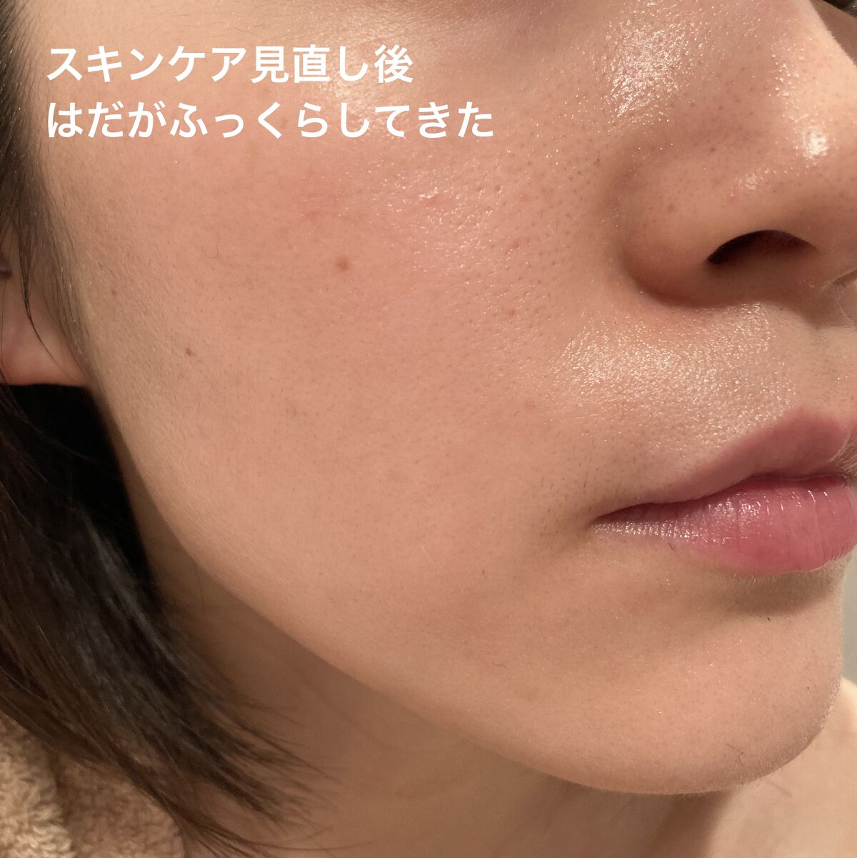 ポーラ　アペックス　セラム　913 試してみた】APEX アペックス セラム 913の効果・肌質別の口コミ