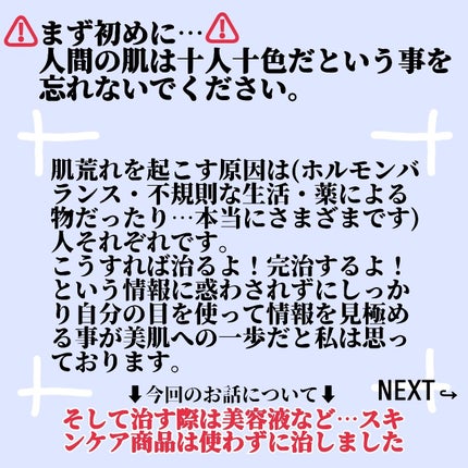 ドクダミ 77 スージングトナー/Anua/化粧水を使ったクチコミ(2枚目)