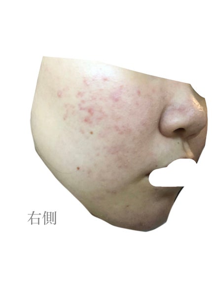 ハトムギ化粧水(ナチュリエ スキンコンディショナー R )/ナチュリエ/化粧水を使ったクチコミ(3枚目)